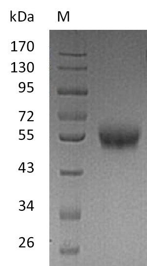 Tumor necrosis factor receptor superfamily member 9 (TNFRSF9), partial (Active), human, recombinant