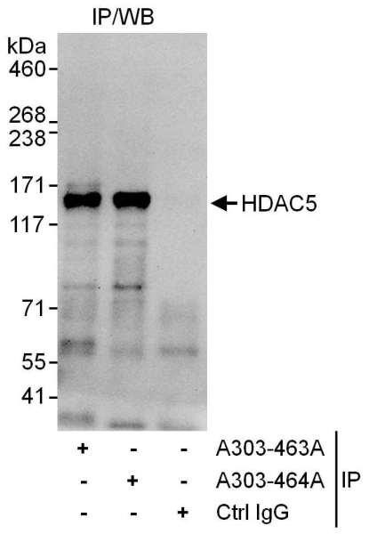 Anti-HDAC5