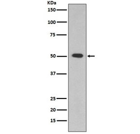 Anti-ALDH1A1, clone AHA-1