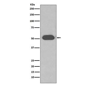 Anti-VDBP / Vitamin D binding protein, clone AOIA-7