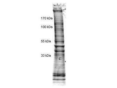 HeLa Cell Nuclear Extract - Doxorubicin Stimulated (1.0 mg/ml by Lowry assay in 1X SDS-PAGE Sample B