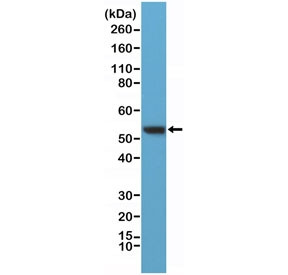 Anti-Vimentin (C-Terminal) (recombinant antibody), clone RM289