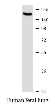 Anti-Aminopeptidase A