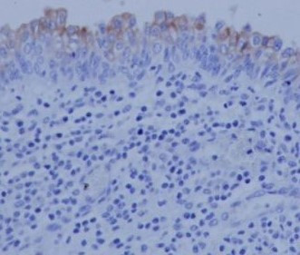 Anti-Uroplakin III
