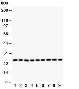 Anti-SOD2 Superoxide Dismutase 2