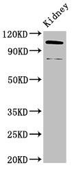Anti-ACTN4