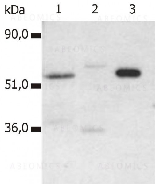 Anti-CD4 Monoclonal Antibody (Clone:MEM-115)