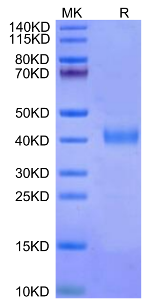 Cynomolgus IL-2 R beta/CD122 Protein