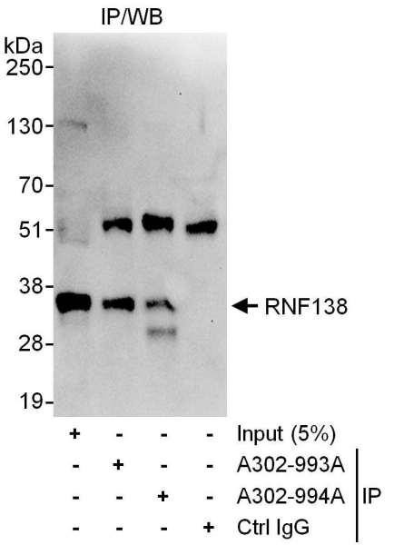 Anti-RNF138