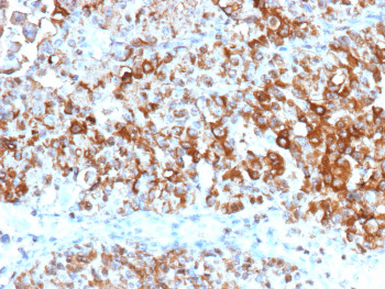 Anti-UPK2 / Uroplakin 2, clone UPK2/13348R