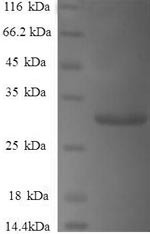 Gamma-synuclein (SNCG), human, recombinant