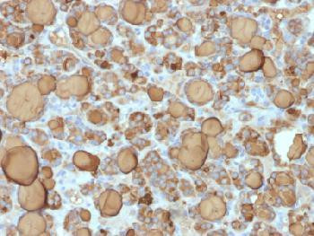 Anti-Thyroglobulin (Thyroidal Cell Marker) Recombinant Rabbit Monoclonal Antibody (clone:TGB/1968R)