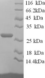 Junctional adhesion molecule B (JAM2), partial, human, recombinant
