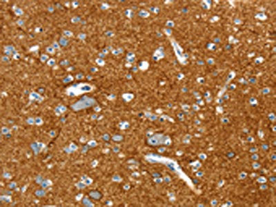 Anti-PTPN3