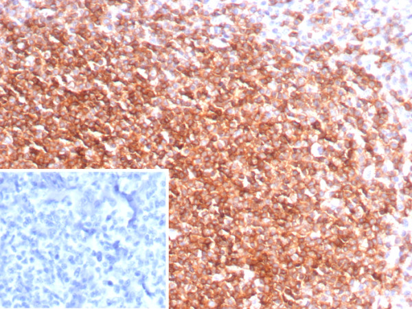 Anti-CXCR5 (Marker of T Follicular Helper (Tfh) Cells), recombinant antibody, clone CXCR5/8146R