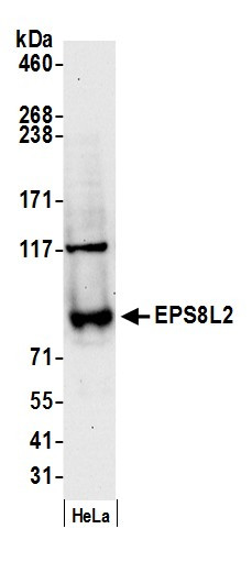 Anti-EPS8L2