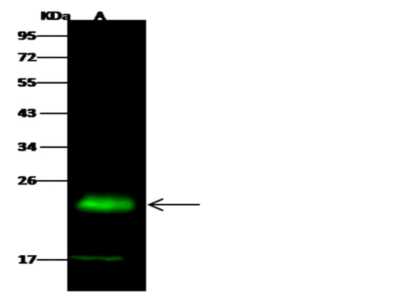 Anti-PMVK/phosphomevalonate kinase Monoclonal Recombinant Antibody