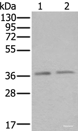 Anti-ATXN7L3