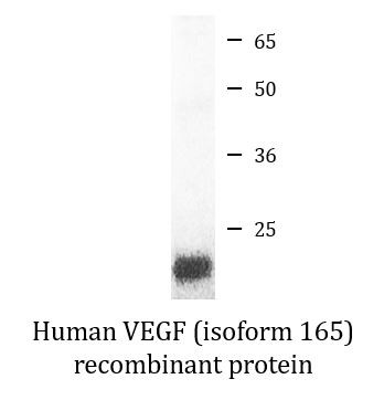 Human VEGF (isoform VEGF165) recombinant protein (Active)