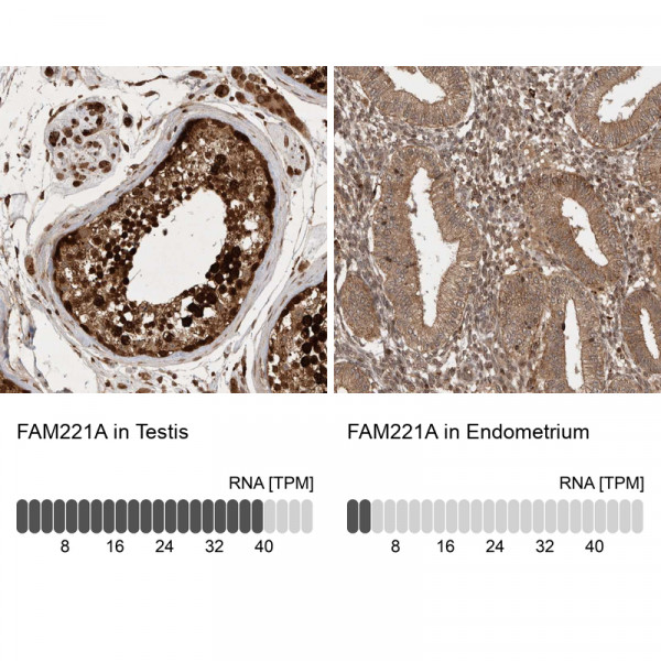 Anti-FAM221A