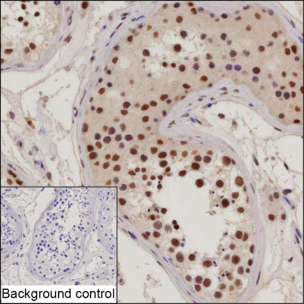 Anti-RANBP3