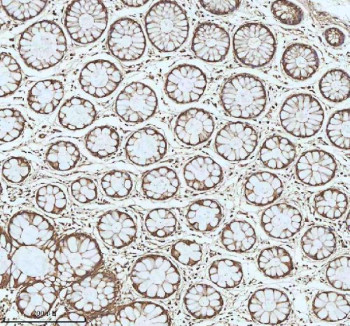 Anti-MYH14 / Myosin 14