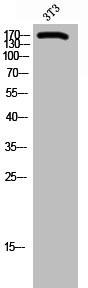Anti-ARID1B