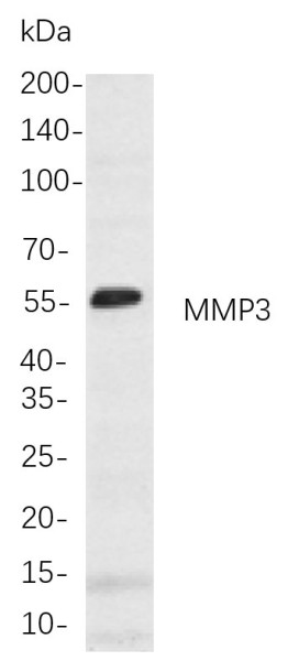 Anti-Recombinant MMP3, clone 3P7