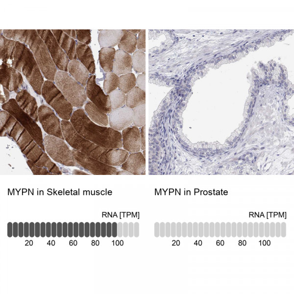 Anti-MYPN
