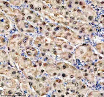 Anti-TKFC / Triokinase/FMN cyclase