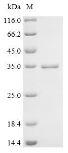 Acetylcholine receptor subunit beta (CHRNB1), partial, recombinant human