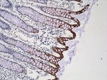 Anti-Cytokeratin 20 / CK20, clone RM283 (recombinant antibody)