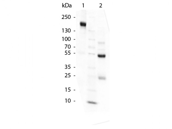 Swine Gamma Globulin Fraction