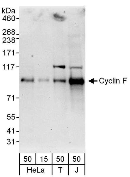 Anti-Cyclin F