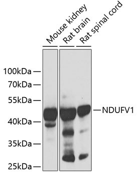 Anti-NDUFV1
