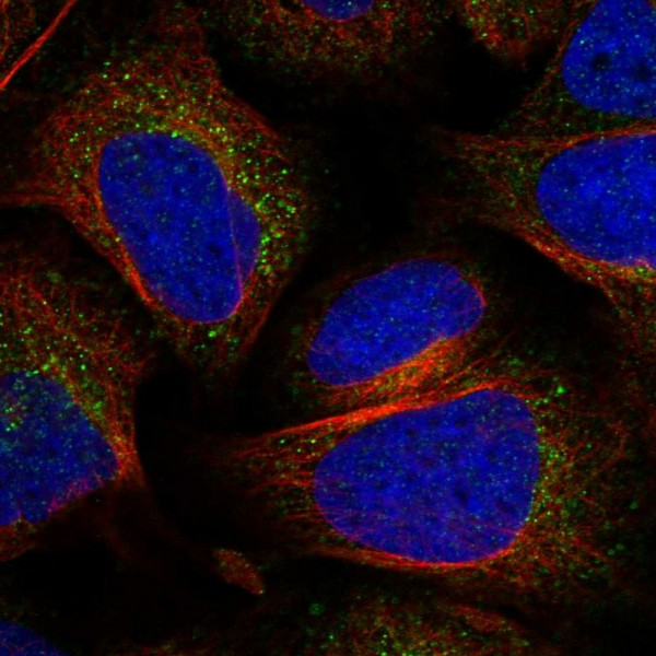 Anti-PTPN9