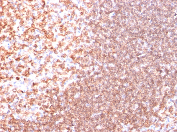 Anti-CD74 (B-Cell Marker), clone SPM523