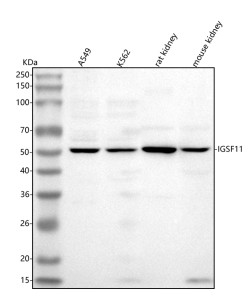 Anti-IGSF11 / Immunoglobulin superfamily member 11