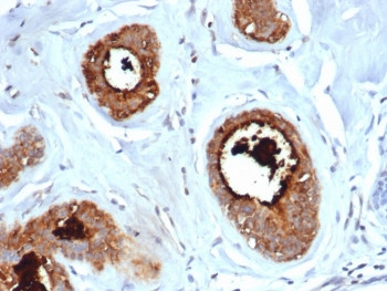 Anti-Mammaglobin A / SCGB2A2, clone rMGB/6619