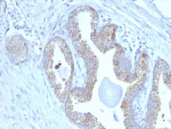Anti-TMEPAI / PMEPA1, clone PMEPA1/2697
