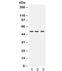 Anti-SPTLC1