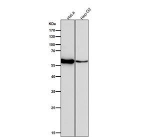 Anti-LYN / Tyrosine-protein kinase Lyn, clone 32L39