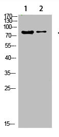 Anti-COL8A2