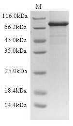 ATP-binding cassette sub-family D member 1 (ABCD1) (Active), human, recombinant