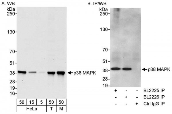 Anti-p38 MAPK