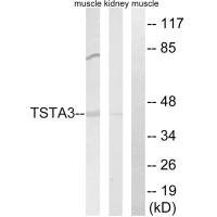 Anti-TSTA3