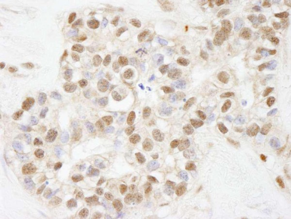 Anti-ARID1B (IHC)