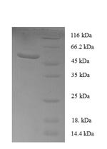 Sclerostin domain-containing protein 1 (SOSTDC1), human, recombinant
