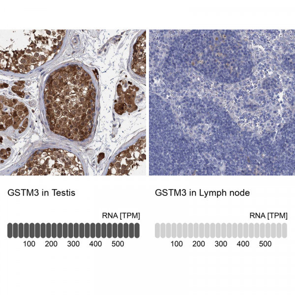 Anti-GSTM3
