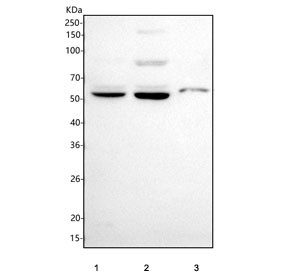 Anti-GABA Transporter 1 / GAT-1 / SLC6A1
